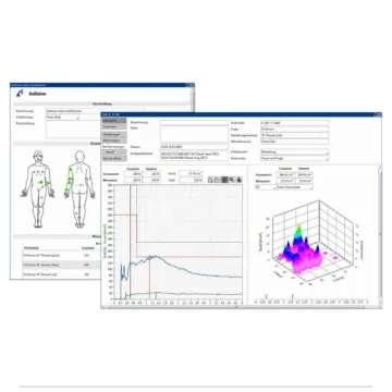CoboSafe-Vision measurement report with body-zone analysis